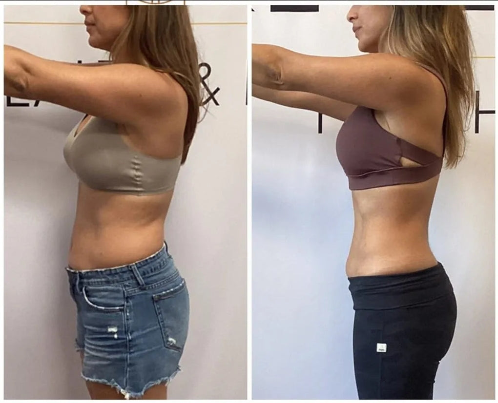 Red Light Physical Therapy Belt